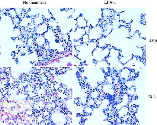 Figure 4. Histologic analysis of lung morphology of HA-Tg mice. D4 cells (10 × 106) were injected intravenously with or without anti–LFA-1 antibody. Lungs were harvested at 48 or 72 hours following cell transfer, sectioned, and stained with H&E. The extent of interstitial inflammation is much less in the anti–LFA-1–treated group compared with the untreated group at 48 hours. Lungs harvested from animals receiving untreated D4 cells show more cellular infiltration and a greater and more widespread thickening of the alveolar walls. At 72 hours, significant alveolitis and mononuclear infiltration of the alveolar spaces are evident in the untreated lungs. Original magnification, × 40. Inset, × 100 magnification.
