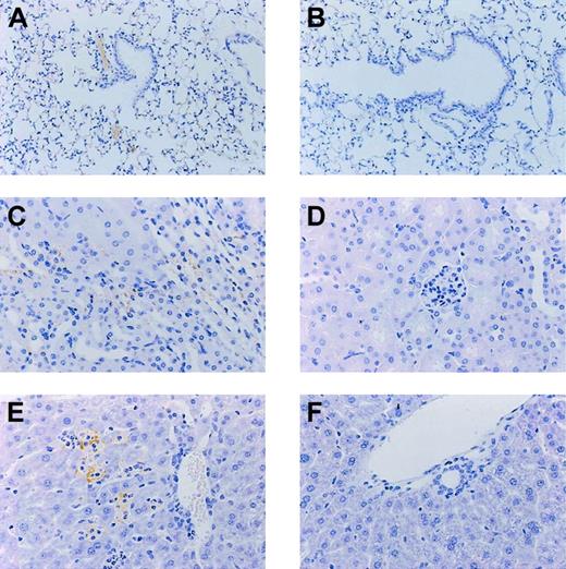 Figure 3. Fibrin staining. Lung (A-B), kidney (C-D), and liver (E-F) of mice at 12 hours after administration of endotoxin. Mice with a heterozygous deficiency of protein C (A,C,E) are compared with wild-type littermates (B,D,F). Slides are representative for 6 mice per group. Original magnification for all panels, × 50.