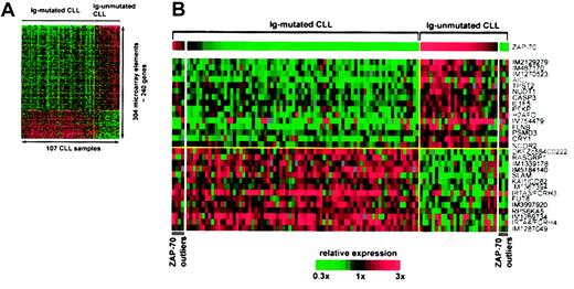 Figure 1. DNA microarray analysis identifies genes that are differentially expressed between Ig-mutated and Ig-unmutated CLL. The relative level of gene expression is depicted according to the color gradient at the bottom. For each array element, the scale is centered at the best distinction cutoff between the CLL subtypes. Red indicates higher expression, and green indicates lower expression of a given gene in the respective subgroup. (A) Expression profile of CLL subtype distinction genes. Relative expression levels of 304 Lymphochip array elements representing approximately 240 genes that were differentially expressed between Ig-mutated and Ig-unmutated CLL at a significance of P < .001 are shown. Columns represent individual patients (n = 107), and rows represent individual array elements. (B) ZAP-70 is the best CLL subtype distinction gene. The 30 most differentially expressed (P < .00001) genes between Ig-mutated and Ig-unmutated CLL are shown. Patients are grouped by their IgVH mutation status and, within subtypes, are arranged by the relative expression level of ZAP-70. Patients discordant for IgVH mutation status and ZAP-70 expression (ZAP-70 outliers) appear at the left (Ig-mutated CLL, ZAP-70 expression above cutoff) and right (Ig-unmutated CLL, ZAP-70 expression below cutoff) ends of the spectrum. Genes are labeled with the gene symbols. For unnamed genes the IMAGE clone numbers (IM) are given. The upper half contains genes more highly expressed in Ig-unmutated CLL and the lower half contains genes more highly expressed in Ig-mutated CLL. In each group, genes are arranged from top to bottom in descending order of statistical significance.