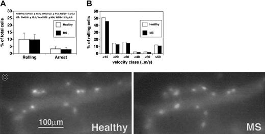 Figure 2. CD4+ lymphocytes from patients with acute MS do not show increased rolling and sticking in brain venules. CD4+ cells were isolated from 4 patients and 4 healthy controls. Experiments were performed in 4 mice. Ten venules were examined. (A) Rolling and arrest fractions were compared between healthy controls (□) and MS patients (▪). Mean ± SD are presented. D indicates diameter. (B) Velocity histograms were generated by measuring rolling velocities. Frequency distributions were calculated after cells were assigned to velocity classes from more than 0 μm/s to 10 μm/s, 10 to 20 μm/s, 20 to 30 μm/s, and so on. Sixty-one rolling cells were examined from healthy donors (□), and 69 rolling cells were considered from patients with acute MS (▪). (C) Adherent CD4+ T cells obtained from a healthy donor (Healthy) (CMFDA-labeled) and a patient with acute MS (MS) (CMTMR-labeled) in the same cerebral venule.