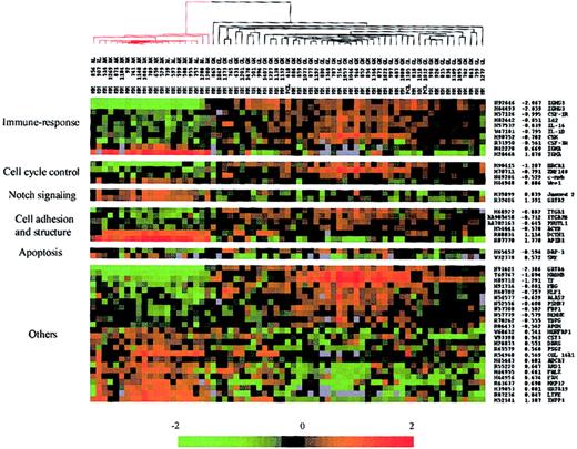 Figure 2. Hierarchic clustering of IgH-secreting MM based on the identified genes (49 members) that best distinguished IgG-MM from IgA-MM. Red-colored branches represent IgA-MM, and black branches represent IgG-MM. Genes were grouped in potential functional categories. Each column represents an MM sample, and each row represents an individual gene. A pseudocolor representation of gene expression is shown according to the scale at the bottom; red indicates expression levels greater than the median, and green indicates levels less than the median. Gene accession numbers, discriminating scores, and gene symbols are labeled on the right. Gray indicates excluded values.