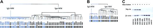 Figure 4. Dendrogam representing the hierarchic clustering of MM patients in stage III and PCL with known bone lesions; score based on the genes of Igλ expression signature. (A) Hierarchic tree of 53 MMs (preliminary group). (B) Hierarchic tree of 19 MMs (validation group). Blue-colored branches represent MMs showing absence or limited bone lesions; black branches represent MMs displaying multiple bone lesions. (C) RT-PCR experiments showing Mip-1α mRNA expression in 8 patients, labeled (+) for multiple bone lesions or (–) for absence of or limited bone lesions. Control indicates no template in the PCR reaction.