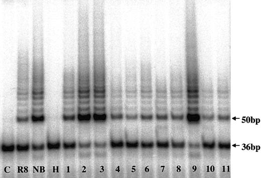 Figure 1. Telomerase activity in CD138+ myeloma and normal plasma cells by TRAP assay. Telomerase activity in marrow myeloma cells from MM patients (lanes 1-9) and in marrow plasma cells from healthy donors (lanes 10-11) are shown. C indicates PCR-negative control; R8, TA-positive control template; NB, neuroblastoma cell line; H, heat-inactivated control; 36bp, internal standard.