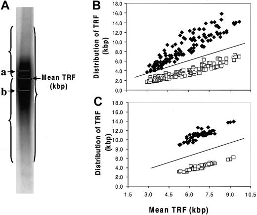 Figure 5. Stabilization of the shortest telomeres in myeloma cells. (A) Telomere distribution in a Southern blot smear. a indicates mean TRF of longer telomeres (⋄, kbp); b, mean TRF of shorter telomeres (□, kbp). Results showed that the distribution of longer telomeres and shorter telomeres was constant relative to the mean TRF in the 5.5- to 9.0-kbp range (B), and the patients' own granulocytes showed a similar relationship (C). Progressive shortening of the longest telomeres was seen in MM cells when mean TRF fell from 5.5 to 3.0 kbp, with stabilization of the shortest telomeres (B). This was not seen in the granulocytes, though the shortest mean TRF was 5.0 kbp or more (C). The lines shown in panels B and C were y = x reference lines.