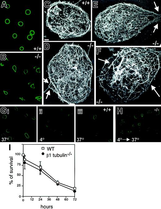 Figure 1. β1-tubulin—/— platelets have abnormal marginal MT band structure. Confocal immunofluorescence with anti–α-tubulin antibody (A) and rapid-freeze electron microscopy (C) of wild-type (+/+) platelets illustrate the normal appearance and thickness of the marginal band. In β1-tubulin—/— platelets (B,D-F), the same structure is thinner, usually deformed, frequently broken (arrows in E-F) or kinked (B, arrows in D), and generally disorganized (F); these features are never encountered in wild-type platelets. Scale bar (C-F) = 0.2 μm. The exposure time for panel B is longer than for panel A to account for the difference in MT band thickness and to allow delineation of the structural anomalies. Both +/+ (G) and β1-tubulin—/— (H) platelets show disassembled MTs at 4°C but regenerate a circumferential marginal band at 37°C. (I) The survival kinetics of transfused wild-type and β1-tubulin—/— platelets in recipient mice are indistinguishable. CMFDA-labeled platelets (108) were injected into +/+ recipients of the same genetic background, blood was collected at the indicated time points, and in vivo survival of the injected platelets (mean ± SD from 4 independent donors of each genotype) was assessed by flow cytometry. Original magnification for all immunofluorescence images, × 1000.