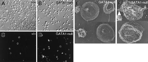 Figure 2. GATA-1–deficient platelets lack the characteristic discoid shape and harbor defective marginal bands. (A-B) Representative microscopic fields of resting platelet populations examined by differential interference contrast microscopy, showing the characteristic elliptical shape of normal (A) and spherocytosis of GATA-1–null (B) platelets. (C-D) Indirect immunofluorescence for α-tubulin. Most wild-type (+/+) platelets (C) contain prominent MT rings of relatively uniform diameter, whereas GATA-1 null platelets (D) contain marginal bands that stain faintly and are usually deformed or uncoiled. (E-F) Rapid-freeze electron microscopy of fixed (E) or permeabilized (F) GATA1-null platelets. Surface replicas (E) highlight the heterogeneity in size of GATA1-null platelets. MTs are frequently kinked (arrowhead in F), broken, or separated from the cell periphery.