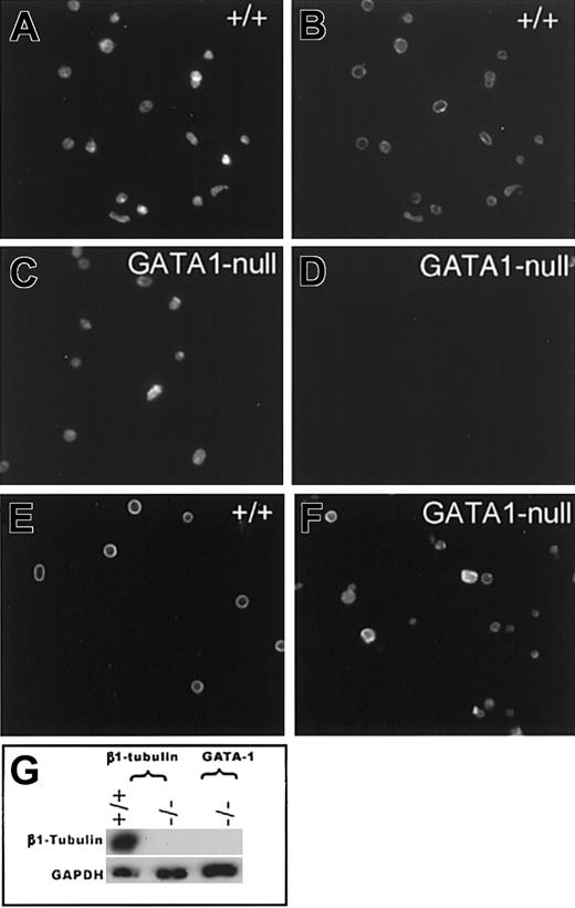 Figure 3. GATA1-deficient platelets lack β1-tubulin. Representative photomicrographs of platelet populations examined by Texas red–phalloidin (A,C) staining and indirect β-tubulin immunofluorescence (B,D-F). Wild-type (+/+) resting platelets show normal, bright staining for β1-tubulin (B), whereas GATA1-null platelets contain no detectable signal (D). Immunostaining with a mixture of β2 and β5 antibodies demonstrates that +/+ (E) and GATA1-null (F) resting platelets contain other β-tubulin isoforms. (G) Immunoblot analysis confirms absence of β1-tubulin in GATA1-deficient platelets. β1-tubulin knockout or wild-type cells and reaction with glyceraldehyde 3-phosphate dehydrogenase (GAPDH) antibody serve as controls.