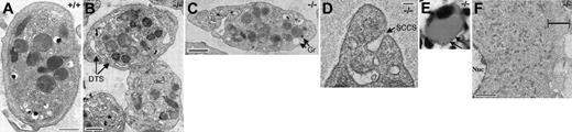 Figure 5. Ultrastructure of β1-tubulin—/— platelets. (A) Wild-type resting platelet, shown to highlight the intact marginal MT band. (B-C) Resting β1-tubulin—/— platelets, showing their normal size and contents. DTS indicates dense tubular system; Gr, granules. (D) Electron micrograph showing the surface-connected canalicular system (SCCS) of β1-tubulin—/— platelets. Scale bars: A-D, 0.5 μm. (E-F) Light (E) and electron (F) micrographs of representative β1-tubulin—/— MKs, showing the common finding of dense cortical staining (arrows) in hematoxylin-and-eosin preparations and nearly normal cytoplasmic maturation, except for a slightly wider organelle-free peripheral zone (delineated by the H-shaped bar) in most MKs. Nuc indicates nucleus; panel E: original magnification, × 400; panel F: scale bar, 5 μm.