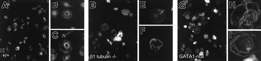 Figure 7. Defective reorganization of β1-tubulin—/— and GATA1-deficient marginal bands with thrombin-induced activation. Anti–α-tubulin immunostaining of wild-type (A-C), β1-tubulin—/— (D-F), and GATA1-null (G-I) platelets stimulated with thrombin and examined under low (A,D,G) or high (B-C,E-F,H-I) magnification. Wild-type platelets reorganize the MT coil into tight central rings with scant radiating fibers, whereas β1-tubulin– and GATA1-null platelets contain unraveled or completely disorganized MTs arranged randomly or in short bundles.