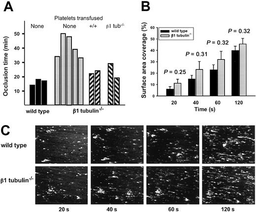 Figure 8. Normal adhesion of β1-tubulin—/— platelets under physiologic shear conditions. (A) Arterial thrombosis model. Wild-type or β1-tubulin—/— mice were injected with fluorescently labeled platelets of matching genotype, and their mesenteries were exposed. When indicated, β1-tubulin–null mice were transfused with 0.5 × 109 wild-type or β1-tubulin–null platelets 18 hours prior to the start of the experiment. Arterioles (60-100 μm in diameter) were selected, vascular injury was provoked by superfusion with ferric chloride, and the time before blood flow ceased for more than 10 seconds was determined. Each bar represents an individual animal. (B-C) Parallel-plate flow chamber studies. Platelets from mice of the indicated genotype were prepared as described in “Materials and methods” and then perfused for 2 minutes over a collagen surface at a wall shear rate of 1000 seconds—1. (B) Surface-area coverage (%) of calcein fluorescence at different time points (20 seconds to 2 minutes) over the perfusion period; n = 5 independent animals of each genotype, and the statistical significance of observed differences between the 2 groups is indicated over each pair of bars. (C) Representative fluorescence images of a portion of the flow chamber for platelets derived from single mice.