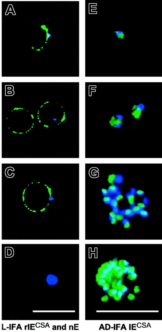 Figure 1. A rhoptry-derived P falciparum parasite molecule binds to the surface of normal and infected erythrocytes. Staining of nEs and IEs from FCR3CSA parasites using mAb B4 (green) in IFA. Parasite DNA is stained with DAPI (blue). (A-D) L-IFA analysis. (E-H) AD-IFA analysis. (A) Merozoite binding to the membrane of an nE stained with anti–RSP-2. (B) Surface staining of an nE (left) and rIE (right). (C) Transfer of RSP-2 from merozoite to the entire erythrocyte surface. (D) A mature trophozoite-stage parasite is not stained by mAb B4. AD-IFA using B4 in young rIEs. (E) Endoplasmic reticulum (ER) in 26 ± 2–hour-old parasites. (F) Rhoptries in 34 ± 2–hour-old schizont stage (G) and surface of free merozoites at 44 ± 2 hours (H). Scale bars measure 10 μm.