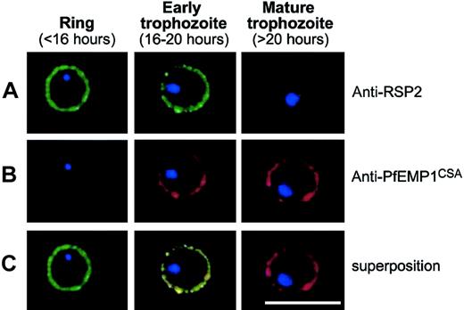 Figure 5. Expression profile of RSP-2 and PfEMP1 at the erythrocyte surface during the blood-stage cycle. RSP-2CSA was stained with mAb B4 (green) and PfEMP1CSA with mAb 1B4/D4 (red) by L-IFA on IE. Parasite nuclei are stained by DAPI (blue). (A) Positive anti–RSP-2 staining on synchronized rIEs (< 16 hours after invasion) and early trophozoites (16 to 20 hours after invasion). No surface staining was detectable on mature forms (> 20 hours after invasion). (B) Absence of PfEMP1 staining on rings (< 16 hours) but strong IFA signal with early trophozoite and mature stages. (C) Superposition of anti–RSP-2 and anti-PfEMP1 staining shows colocalization in early trophozoite stages. Scale bar measures 10 μm.