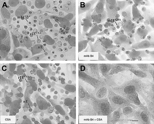 Figure 6. Blocking of rIECSA and mature IECSA adhesion to Sc1D cells in the presence of specific inhibitors. A culture of rIECSA and mature IECSA parasites (equal parasitemia) was passed over confluent Sc1D cells in microslides at 0.05 Pa. (A) Sc1D cells with bound rIECSA and mature IECSA. (B) Flushing with 2 mL 100 μg/mL anti–RSP-2 mAb B4 in culture medium. (C) Flushing with 2 mL 100 μg/mL CSA dissolved in culture medium. (D) nE, rIECSA, and mature IECSA were desequestrated using both inhibitors. Scale bar measures 10 μm.