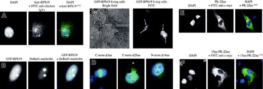Figure 2. Subcellular localization of RPS19. (A) The use of an anti-RPS19 antibody raised in chicken shows primary localization of RPS19 in the nucleus and particularly to the nucleoli in Cos-7 cells (arrows). A weaker and diffuse cytoplasmic staining is also observed. The left panel represents 4′6-diamidino-2-phenylindole (DAPI) staining for the nucleus; the middle panel, FITC staining of RPS19; and the right panel, the merged picture of DAPI and FITC staining. (B) Nucleolar localization of RPS19 is confirmed after transfection of Cos-7 cells with the recombinant GFP–wild-type RPS19 (left panel). RPS19 colocalizes with the major nucleolar protein nucleolin (middle panel) after transfection of Cos-7 cells with GFP–wild-type RPS19 and the red fluorescent DsRed1-nucleolin fusion protein (right panel). (C) Nucleolar localization of RPS19 (arrows) is also observed in live cells after transfection of Cos-7 cells with GFP-RPS19, ruling out an artifactual effect of cell fixation on RPS19 subcellular distribution. (D) Deletion of the last 3 COOH-terminal amino acids does not impair RPS19 localization compared with wild type (left panel). In contrast, deletion of the last 25 COOH-terminal amino acids dramatically alters RPS19 nucleolar import (middle panel). Furthermore, deletion of the first 14 NH2 amino acids also impaired RPS19 nucleolar import (right panel). (E) The 22-amino-acid-long NoS identified in the last 25 amino acids fails to import pyruvate kinase into the nucleoli. (F) Addition of the first NoS to the previous pyruvate kinase construct also fails to be imported into the nucleoli of Cos-7 cells, confirming that although these 2 NoS are necessary, they are not sufficient for nucleolar import. Original magnifications: × 63 (A,B,D,E,F); × 40 (C).