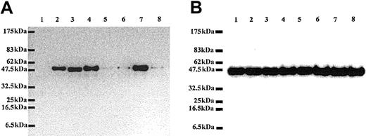 Figure 5. Dramatic differences in level of expression of normal and mutated RPS19. Lysates of Cos-7 cells transfected with different GFP fusion protein constructs including GFP alone (1), GFP-WT RPS19 (2), GFP-mutated RPS19-Arg56Gln (3), GFP-mutated RPS19-Arg62Trp (4), GFP-mutated RPS19-Val15Phe+Thr55Met (5), GFP-mutated RPS19-Val15Phe (6), GFP-mutated RPS19-Thr55Met (7), and GFP-mutated RPS19-Gly127Gln (8) were analyzed by immunoblotting. We probed the immunoblots with chicken polyclonal anti-RPS19 antibody (panel A) or mouse monoclonal antichicken actin antibody (panel B). RPS19 antibody did not cross-react with GFP (panel A, lane 1), confirming its specificity. In contrast, the antibody detected GFP-WT and mutated RPS19 fusion proteins (panel A, lanes 2-8). The Val15Phe and Gly127Gln mutations, which impaired RPS19 nucleolar import, were associated with marked decrease in RPS19 expression (panel A, lanes 5, 6, 8) compared with normal RPS19 (panel A, lane 2). In contrast, expression of RPS19 with mutations located in the hot spot of mutations found in a large number of DBA patients: Arg56Gln, Arg62Trp (panel A, lanes 3-4, respectively) was the same as normal RPS19. Expression level of endogenous β-actin detected in a duplicate blot was similar in all samples, confirming that the amount of proteins loaded in each lane was comparable (panel B, lanes 1-8). Molecular weight standards (MWs) are shown on the left side of the blots.