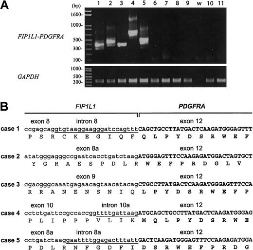 Figure 4. Detection of the FIP1L1-PDGFRA fusion in PBMCs from patients with HES and elevated tryptase. (A) RT-PCR analysis of RNA isolated from PBMCs from patients with HES and elevated serum tryptase (lanes 1-5), patients with HES and normal tryptase levels (lanes 6-9), and patients with a familial form of eosinophilia linked to chromosome 5q (lanes 10-11). The water control is indicated by the letter w. Only patients with elevated tryptase levels (1-5) were positive for the FIP1L1-PDGFRA fusion. Different PCR products are observed in the different cases, due to different breakpoints in the FIP1L1 gene (B). The different bands observed in each case represent splice variants (the sequence of 1 splice variant is shown in panel B), as observed previously.7 GAPDH was amplified as a control for cDNA quality. (B) cDNA and deduced amino acid sequence of FIP1L1-PDGFRA fusions from patients 1 to 5. Sequences derived from FIP1L1 are shown in lowercase; sequences derived from introns of FIP1L1 that are present in the fusion cDNA are underlined; sequences derived from PDGFRA are shown in uppercase in bold. Breakpoints in FIP1L1 are variable (in introns 8, 8a, 9, or 10), but all breakpoints in PDGFRA occur in exon 12. All fusions are in-frame. Exon numbering is according to Cools et al.7