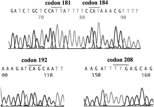 Figure 1. The representative case of direct sequencing analysis for exon 4 polymorphisms of CYP2C9 gene. No polymorphism was found in exon 4 of 50 cases after sequencing analysis.