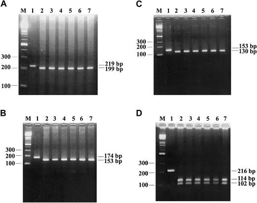Figure 2. The results of PCR-RFLP analysis for 4 polymorphisms in exon 4 of CYP2C9 gene. (A) The results of detection of 608TTG>GTG are shown, the wild type (TTG) is completely digested to 199-bp fragment (lanes 2-7) by TaqI. (B) The results of detection of 561CAG>CCG are shown, the wild type (CAG) is completely digested to 153-bp fragment by AluI (lanes 2-7). (C) The results of detection of 537CAT>CCT are shown, the wild type (CAT) is completely digested to 130-bp fragment by NlaIII (lanes 2-7). (D) The results of detection of 527ATT>CTT are shown, the wild type (ATT) is completely digested to 114-bp and 102-bp fragments by NlaIV (lanes 2-7). M indicates 100-bp ladder marker; and lane 1, uncut control.