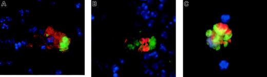 Fig. 5. Ingested RBCs in splenic macrophages of untreated (but not clodronate-treated) mice. / Ingested RBCs are readily apparent in splenic macrophages of untreated mice (but not in clodronate-treated mice). Mice were injected with antibody-opsonized RBCs (109). At 4 to 8 hours later, they were killed and the splenocytes were dispersed, stained, and cytospun onto slides. RBCs were lysed prior to staining until no free RBCs were visible on the slides. (A) Cells were stained for F4/80, a macrophage-specific cell surface molecule, (in green) then fixed and permeabilized for intracellular staining with Ter-119, an RBC specific antibody (in red). (B) Cells were intracellularly stained with anti-CD68 (in red) and anti-RBC (Ter-119, in green). (C) Cells were stained intracellularly for CD68 (in red), and RBCs (in green) are visualized because they were labeled with CFSE prior to administration. In all images, nuclei were counterstained in blue. No ingested RBCs were visible in mice pretreated with liposomal clodronate (data not shown). Original magnifications × 100.