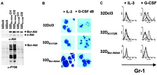 Fig. 1. Bcr-Abl inhibition of G-CSF–induced granulocytic differentiation in 32Dcl3 cells by a kinase-dependent mechanism. / (A) Abl (top panel) and phosphotyrosine (bottom panel) immunoblots of lysates from either 32Dcl3, 32DBcr-Ablwt or 32DBcr-AblK1172R cells. (B) Morphological differentiation of 32Dcl3, 32DBcr-Ablwt, or 32DBcr-AblK1172R cells 8 days after stimulation with G-CSF as assessed by May-Gruenwald-Giemsa staining (original magnification, × 400). Cells grown in the presence of IL-3 are shown as a control. (C) Expression of Gr-1 on 32Dcl3, 32DBcr-Ablwt, or 32DBcr-AblK1172R cells upon G-CSF stimulation. Gr-1 expression on cells grown in the presence of IL-3 is shown as a control.