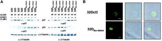Fig. 7. Effect of Bcr-Abl on regulation of the cyclin-dependent kinase inhibitors p21Waf1/Cip1 and p27Kip1. / Bcr-Abl disturbs regulation of the cyclin-dependent kinase inhibitors p21Waf1/Cip1 and p27Kip1. (A) The 32Dcl3 cells and cells of a representative clone of 32DBcr-Ablwt were stimulated with rhG-CSF (left panel). Lysis of the individual cell types was performed at day 0 (prior to G-CSF stimulation) to day 3. In addition, aliquots of 32DBcr-Ablwt cells were grown in the presence of rhG-CSF and 1 μM imatinib mesylate. Lysates of such cells were compared with lysates of G-CSF–treated 32DBcr-Ablwt cells grown in the absence of imatinib mesylate (right panel). Western blot analysis of the different lysates was performed with the use of antibodies to p27Kip1, and p21Waf1/Cip1. Equal protein loading onto individual lanes was controlled by blotting the stripped membrane with anti–β-tubuline ab. (B) Confocal immunofluorescence microscopy of 32Dcl3 and 32DBcr-Ablwt cells for p21Waf1/Cip1. Representative pictures for each cell type are shown. Scale bar measurements, top row, 4.00 μm; bottom row, 8.00 μm.