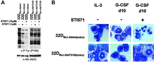 Fig. 8. Effect of imatinib mesylate on G-CSF–induced granulocytic differentiation in 32DBcr-Abl cells expressing an imatinib mesylate-resistant mutant. / Imatinib mesylate fails to restore G-CSF–induced granulocytic differentiation in 32DBcr-Abl cells expressing an imatinib mesylate-resistant mutant. (A) The 32DBcr-Ablwtand 32DBcr-AblThr315Iso cells established by retroviral infection were either left untreated or incubated with 1 or 10 μM imatinib mesylate for 2 hours prior to lysis. Western blot analysis was performed with antibodies to phosphotyrosines and Abl. (B) The 32Dcl3, 32DBcr-Ablwt, and 32DBcr-AblThr315Iso cells were grown in media containing G-CSF. Imatinib mesylate was added at a concentration of 1 μM as indicated. Morphological differentiation of cytospun cells was determined at day 10 by May-Gruenwald-Giemsa staining (original magnification, × 400). Cells grown in the presence of IL-3 are shown as a control.