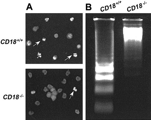 Fig. 4. Analysis of nuclear morphology and DNA degradation. / (A) Epifluorescence photomicrographs of isolated blood PMNs fromCD18+/+ mice orCD18−/− mice stained with acridine orange 4 hours after the onset of culture. Results are representative of 3 independent experiments. (B) Agarose gel of low-molecular-weight DNA of isolated blood PMNs fromCD18+/+ orCD18−/− mice 4 hours after the onset of culture. Results are representative of 3 independent experiments.
