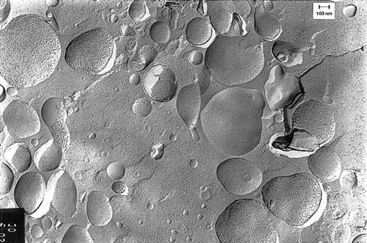 Fig. 2. Freeze-fracture electron microscopy of vesicles. / Vesicles were isolated from plasma obtained by pheresis from a healthy blood bank donor. The sidedness of the vesicles can be deduced from the density of the intramembranous particles on the convex and concave fracture faces of the RBC membranes. This density is 3 times higher on the protoplasmic than on the exoplasmic fracture face.10