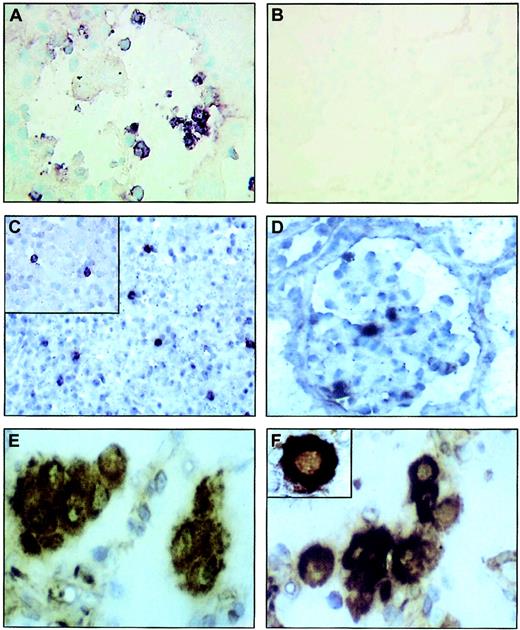 Fig. 1. GILZ gene expression in normal human tissues. / GILZ gene expression was studied by in situ hybridization in the lungs (A-B), liver (C), and kidneys (D), with either an antisense (A, C-D) or a sense (B) GILZ probe. In lung samples, macrophages were identified by immunohistochemistry with anti-CD68 antibodies (E), and GILZ gene–expressing cells were identified by double-labeling experiments in which in situ hybridization with use of the GILZ antisense probe (dark blue) was combined with immunohistochemistry with an anti-CD68 antibody (brown; F). The results shown are representative of experiments performed on 3 different lungs, livers, and kidneys. Original magnifications A-B, × 400; C, × 250; inset C, × 400; D, × 400; E-F, × 1600; inset F, × 2000.