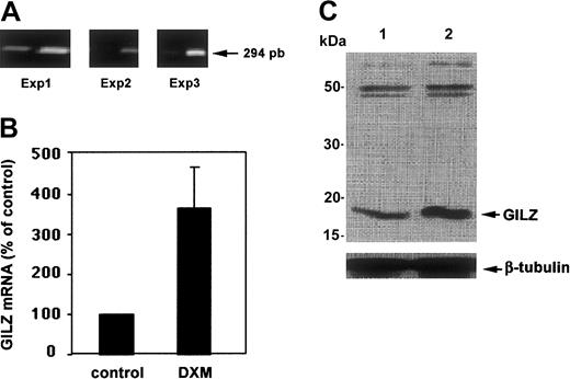 Fig. 2. In vitro induction of GILZ by GCs. / Production of GILZ by human monocytes cultured alone or with DXM was studied by RT-PCR (A-B) and by Western blotting (C). (A) GILZ RT-PCR, 3 experiments. (B) Optical density of products amplified from GILZ mRNA (mean ± SEM) in these 3 experiments. (C) GILZ protein in cells cultured without (lane 1) or with (lane 2) DXM. Results from 1 experiment representative of 2 are shown.
