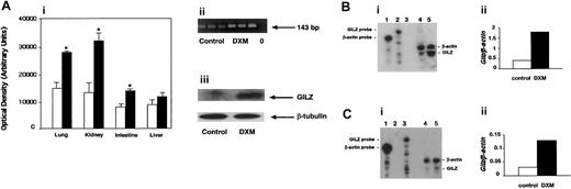 Fig. 5. In vivo induction of GILZ in mice. / (A) Production of GILZ was evaluated in mice treated with PBS (control, n = 6) or with DXM (n = 6). GILZ gene expression was measured by RT-PCR. (i) Optical density of products amplified from GILZ mRNA (means ± SEMs), *P < .01 (Mann-WhitneyU test). ■ indicates control; ▪, treated with DXM. (ii) A typical result for analysis of GILZ gene expression in the lung from 3 control and 3 DXM-treated mice. 0: negative control, with no cDNA. (iii) Presence of GILZ and β-tubulin in the lung of control and DXM-treated mice, as analyzed by Western blotting. Results shown are from 1 experiment representative of 2. (B) In vitro and (C) in vivo GILZ gene expression by peritoneal macrophages were evaluated by RNase protection assay (RPA). (Bi, Ci) Lanes 1 and 2: undigested β-actin and GILZ probes, respectively; lane 3: RPA in the presence of yeast RNA. (Bi) Lanes 4 and 5: macrophages cultured alone and with DXM, respectively. (Ci) Lanes 4 and 5: macrophages from control and DXM-treated mice, respectively. The ratios between protected GILZ and β-actin probes for lanes 4 and 5 are shown in panels Bii and Cii.