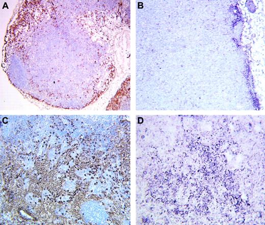 Fig. 6. GILZ gene expression in IL-10 transgenic mice. / Expression of Mac-1 (A,C) and GILZ gene (B,D) was analyzed by immunohistochemistry and by in situ hybridization, respectively, in BALB/C mice (A-B) and in IL-10 transgenic mice (C-D). Original magnifications A, × 100; B, × 160; C-D, × 250.