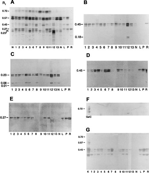 Fig. 2. Immunologic detection of neolacto- and globo-family GSLs, including Gb3, in acute myeloid leukemia. / Neutral GSLs from ANLL (lanes 1-11), CML (lanes 12 and 13), and peripheral blood neutrophils (N), lymphocytes (L), platelets (P), and red cells (R) were separated by HPTLC and chemically stained with DPA or immunostained with carbohydrate-specific MoAbs and lectins (Table4). (A) DPA spray, (B) MoAb TE5, (C) MoAb IB2, (D) MoAb Pk002, (E) MoAb MC631, (F) MoAb Gal01, and (G) Stx. Lane numbers for ANLL and CML refer to individual sample numbers shown in Tables 2, 3, and 5. Numbers to left of figures refer to the relative mobility (Rf) of specific GSLs. GSL controls included galactosylceramide (GalC, panel F) and kidney neutral GSLs (K, panel G). Bracketed bands (E, lane 12) represent nonspecific binding. Solvent was C/M/W 60:30:5 (vol/vol).