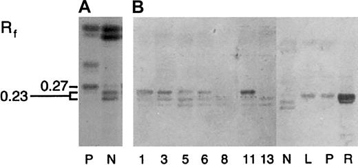 Fig. 7. Parvovirus B19 binds both Gb4 and nLc4 in ANLL. / (A) The total neutral GSL fraction from human platelets (P) and normal granulocytes (N), separated by HPTLC and chemically stained with DPA. (B) Neutral GSLs immunostained with parvovirus B19 capsids. GSL samples include the total neutral GSL fractions from ANLL (samples 1, 3, 5, 6, 8, 11; Tables 2 to 4), CML (sample 13), neutrophils (N), lymphocytes (L), platelets (P), and red cells (R). Numbers on left indicate the mobility of Gb4 (Rf 0.27) and nLc4(Rf 0.23). Solvent, C/M/W 65:30:5 (vol/vol).
