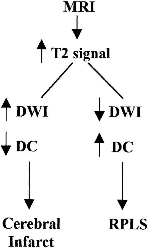 Fig. 4. Characterization of T2-weighted hyperintensities on MRI of the brain distinguishing cerebral infarct from reversible posterior leukoencephalopathy syndrome (RPLS). / DWI indicates diffusion weighted image; DC, diffusion coefficient.