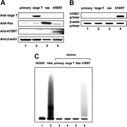 Fig. 2. Expression of ras, large T, or hTERT in the transduced human stromal cell lines. / Expression of the transgene was analyzed by immunoblot analysis (panel A), by RT-PCR (panel B), or by the level of telomerase activity (panel C). (A) Lane 1, primary stromal cells; lane 2, large T–stromal cells; lane 3, ras-stromal cells; lane 4, hTERT-stromal cells. Anti–large T indicates primary antibody for SV40 large T protein; anti-Ras, antibody for H-ras protein; anti-hTERT, antibody for hTERT protein; anti–β-actin, antibody specific for β-actin protein, as an internal standard. (B) Lane 1, primary stromal cells; lane 2, large T–stromal cells; lane 3, ras-stromal cells; lane 4, hTERT-stromal cells. RT-PCR was performed for the integrated hTERT provirus sequence and the β-actin sequence as an internal standard. (C) Lane 1, human vascular endothelial cells (HUVECs); lane 2, Hela cells; lane 3, primary stromal cells; lane 4, large T–stromal cells; lane 5, ras-stromal cells; lane 6, hTERT-stromal cells.