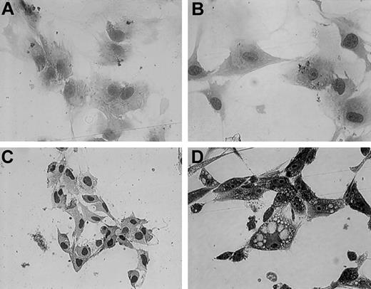 Fig. 3. May-Giemsa staining of primary stromal, hTERT-stromal, large T–stromal, and ras-stromal cells. / (A) Primary stromal cells. (B) hTERT-stromal cells. (C) large T–stromal cells. (D) ras-stromal cells. Original magnification for all panels, × 100.