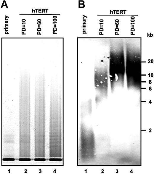 Fig. 6. Telomerase activity and telomere length of primary or hTERT-stromal cells. / (A) Telomerase activity. Lane 1, primary stromal cells; lane 2, hTERT-stromal cells at PD = 10; lane 3, hTERT-stromal cells at PD = 60; lane 4, hTERT-stromal cells at PD = 100. (B) Telomere length. Lane 1, primary stromal cells; lane 2, hTERT-stromal cells at PD = 10; lane 3, hTERT-stromal cells at PD = 60; lane 4, hTERT-stromal cells at PD = 100.