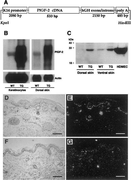 Fig. 1. Targeted expression of transgenic PIGF-2 in epidermal keratinocytes. / (A) Schematic representation of the K14–PlGF-2 transgene construct. A 533-bp human PlGF-2 cDNA fragment was ligated to the BamHI restriction site of the keratin 14 promoter cassette. (B) Overexpression of PlGF-2 mRNA in the dorsal skin of 3-week-old K14–PlGF-2 transgenic mice and in cultured epidermal keratinocytes isolated from PIGF-2 transgenic mice was confirmed by Northern blot analysis. Hybridization with a murine β-actin probe served as control for equal loading. (C) Western blot analysis of skin lysates demonstrates the presence of the intact PlGF-2 protein in PlGF-2 transgenic (TG) skin. Low levels of endogenous PlGF-2 were detected in wild-type (WT) skin. Conditioned media obtained from human dermal microvascular endothelial cells (HDMEC) served as positive controls. (D-E) Targeted overexpression of the K14–PlGF-2 transgene in the basal epidermal keratinocyte layer and in outer root sheath keratinocytes of hair follicles was confirmed by in situ hybridization in 2-week-old transgenic mice. (F-G) Low-level epidermal expression of the K14–PlGF-2 transgene was observed by in situ hybridization in adult, 8-week-old transgenic mice. Bright-field (D,F) and dark-field (E,G) micrographs. Scale bars = 50 μm.