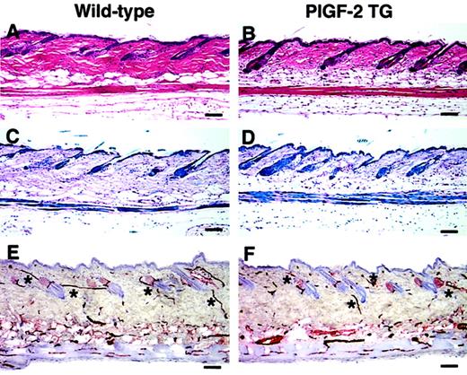 Fig. 2. Normal skin structure and vascularization in adult PlGF-2 transgenic and wild-type mice. / Histologic analysis of the back skin of 8-week-old PlGF-2 transgenic mice (B,D) showed no major differences in the thickness and morphology of the epidermis and the dermis as compared with wild-type littermates (A,C). (A-B) Hematoxylin and eosin stains; (C-D) trichrome stains. CD31 stains demonstrated comparable vascularization of the skin of PlGF-2 transgenic mice (F) and of wild-type littermates (E). *Cutaneous vessels. Scale bars = 50 μm.