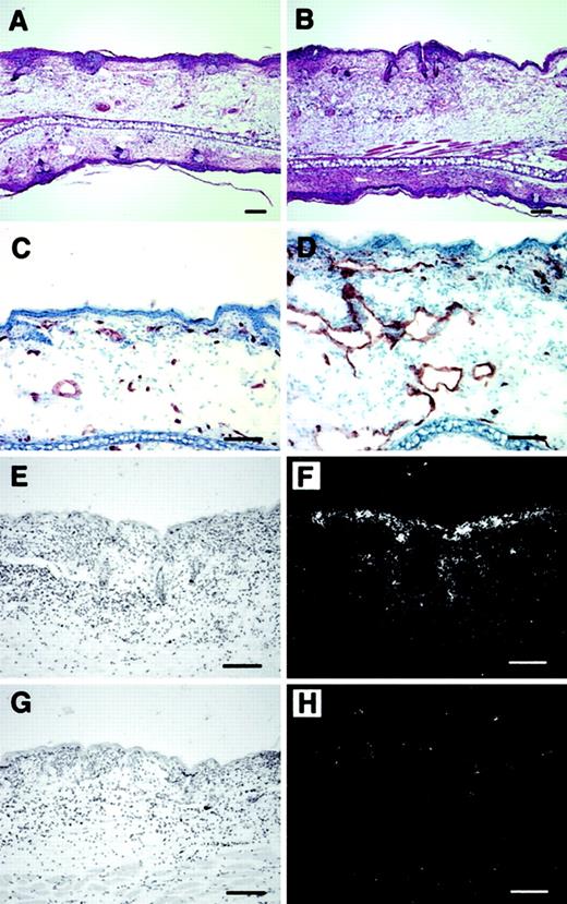 Fig. 4. Increased angiogenesis and inflammation in cutaneous DTH reactions elicited in PlGF-2 transgenic mice. / Increased edema formation and inflammatory infiltration in the skin of PlGF-2 transgenic mice (B) at 24 hours after antigen challenge as compared with wild-type mice (A). Hematoxylin and eosin stains. CD31 stains demonstrated enhanced angiogenesis at 24 hours after challenge in PlGF-2 transgenic mice (D) as compared with wild-type mice (C). (E-H) In situ hybridization confirmed high levels of human PlGF-2 mRNA expression in transgenic epidermal keratinocytes at 24 hours after challenge (E-F), whereas no hybridization signal for human PlGF-2 was detected in wild-type mice (G-H). Bright-field (E,G) and dark-field (F,H) micrographs. Scale bars = 50 μm.