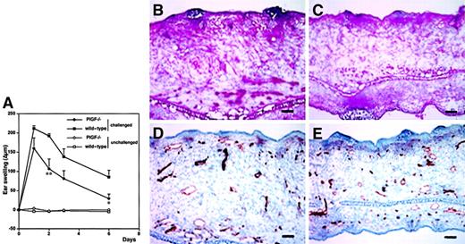 Fig. 6. Decreased and abbreviated ear swelling and diminished angiogenesis in DTH reactions elicited in PlGF-2–deficient mice. / DTH reactions were induced in the ear skin of PlGF-2–deficient and wild-type mice using oxazolone. (A). Ear swelling is expressed as the increase (Δ) over the original ear thickness in micrometers. PlGF-2–deficient mice (●) showed a significantly decreased ear swelling (P < .01 at 48 hours; P < .05 at 24 hours, 3 and 6 days after challenge) as compared with wild-type mice (▪). Moreover, the duration of ear swelling in PlGF-2–deficient mice was abbreviated. Unchallenged mice: ○, PlGF-2–deficient mice; ■, wild-type mice. Data are expressed as means ± SEMs. **P < .01. Diminished edema formation and inflammatory infiltration in the skin of PlGF-2–deficient mice (C) at 24 hours after antigen challenge as compared with wild-type mice (B). CD31 stains demonstrated absence of large angiogenic vessels 24 hours after challenge in PlGF-2–deficient mice (E) as compared with wild-type mice (D). (B-C) Hematoxylin and eosin stains. (D-E) CD31 stains. Scale bars = 50 μm.