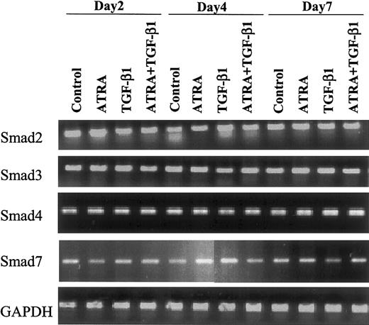 Fig. 1. Effect of ATRA versus TGF-β1 on expression of Smad mRNAs. / Expression of Smad mRNAs is not changed following induction of differentiation of HL-60 cells to monocytes or granulocytes by 10 nM ATRA or 10 ng/mL TGF-β1. Human Smad-specific primer pairs were selected from the corresponding cDNA sequence information obtained from the National Institutes of Health (NIH) database as indicated in “Materials and methods.” Primer pairs were used to amplify Smad-specific fragments from reverse-transcribed total RNA isolated from the indicated samples as template. In all cases, 1 μg total RNA, quantified by spectrophotometry and agarose gel analysis, was used for reverse transcription. Smad2, Smad3, Smad4, Smad7, and GAPDH (as an internal control) were amplified by PCR and analyzed on an agarose gel.