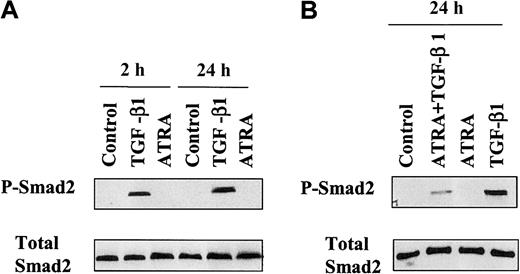 Fig. 2. Western blot analysis of activation of endogenous Smad2 in HL-60 cells. / Protein prepared from HL-60 cells untreated or treated with 10 ng/mL TGF-β1 or 10 nM ATRA (A) or treated with both (B) for the indicated times, as described in “Materials and methods,” were directly subjected to immunoblotting with antibodies against Smad2 (Total Smad2) or C–terminally phosphorylated Smad2 (P-Smad2).