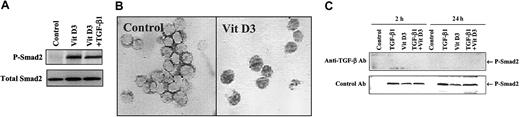 Fig. 5. Vitamin D3induction of activation of Smad2/Smad3 in HL-60 cells. / Vitamin D3 induces activation of Smad2/Smad3 in HL-60 cells in a TGF-β–dependent manner. (A) Western blot analysis of phosphorylation of endogenous Smad2 in HL-60 cells untreated or treated with 100 nM Vit D3 for 24 hours. (B) Immunohistochemical staining of Smad3 in HL-60 cells untreated (Control) or treated with 100 nM Vit D3 at 18 hours. Original magnification × 400. (C) TGF-β1–neutralizing antibodies block the phosphorylation of Smad2 induced by treatment of Hl-60 cells with either 10 ng/mL TGF-β or 100 nM Vit D3. Lysates from cells incubated in either the presence or absence of 12.5 μg/mL TGF-β1 control (12H5) or neutralizing (1D11) antibody at 2 hours or 24 hours were directly subjected to immunoblotting with antibodies against Smad2 (not shown) and phosphorylated Smad2.