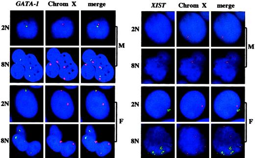 Fig. 3. Analysis of the accumulation of. / GATA-1 gene nuclear RNA and XIST RNA and of the ploidy level in polyploid megakaryocytes from male and female individuals.The experiments were performed and the results are presented as in Figure 1A except that a GATA-1 or XIST probe and a centromeric probe for chromosome X (Oncor) were used. M indicates male; F, female. 2N, 8N indicate the ploidy level. Original magnification × 60.