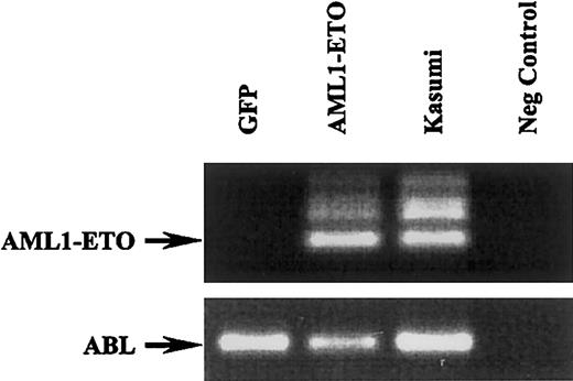 Fig. 2. AML1-ETO expression in human cord blood progenitor cells transduced with retrovirus expressing GFP and AML1-ETO. / RT-PCR analysis of GFP- and AML1-ETO–transduced cells and corresponding RT-PCR of ABL (bottom blot). The Kasumi-1 cells were used a positive control and water as a negative control.