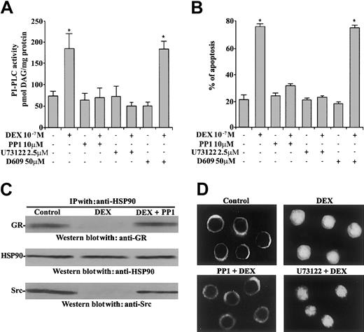 Fig. 1. Src activity involvement in DEX-induced thymocyte apoptosis. / Effect of PP1 on DEX-induced PI-PLC activity, apoptosis, GR assembly, and GR nuclear translocation. (A) Thymocytes were pretreated for 30 minutes with PP1 (10 μM), U73122 (2.5 μM), and D609 (50 μg/mL) and then with DEX (10−7 M, 5 minutes). To evaluate PI-PLC activity, cell extracts were reacted with radiolabeled PI vesicles, and then the DAG released was separated by TLC and visualized by autoradiography. *P < .001. (B) Effect of PP1, U73122, and D609 on DEX-induced thymocyte apoptosis, as detected after 18 hours of culture with DEX (10−7 M). Apoptosis was evaluated by PI staining and FACScan flow cytometer. Mean values ± SE of 3 different experiments in duplicate are reported. *P < .001. (C) Thymocytes were pretreated for 30 minutes with PP1 (10 μM) before treatment with DEX (10−7M, 30 minutes). Cell lysates were immunoprecipitated (IP) with anti-HSP90 antibody and then Western blotted with anti-HSP90, anti-GR, and anti-Src antibodies. (D) Immunofluorescence analysis of thymocytes untreated or treated for 30 minutes with DEX alone or in combination with PP1 and U73122. After treatment, cells were stained with anti-GR antibody using the paraformaldehyde-saponin procedure.