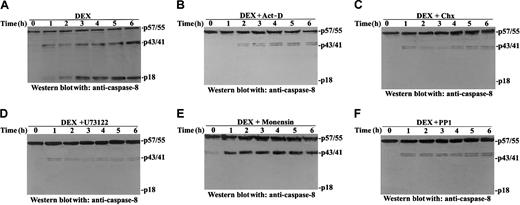 Fig. 7. Effects of protein synthesis inhibitors (act-D and Chx), monensin, PP1, and U73122 on DEX-induced caspase 8 activation. / Thymocytes were treated for different times with DEX (10−7M; A) or were pretreated for 30 minutes with 2.5 μg/mL act-D (B), 50 μg/mL Chx (C), 2.5 μM U73122 (D), 10 μg/mL monensin (E), or 10 μM PP1 (F) before DEX treatment. Caspase-8 cleavage was evaluated by Western blot analysis with anti–caspase-8 antibody.