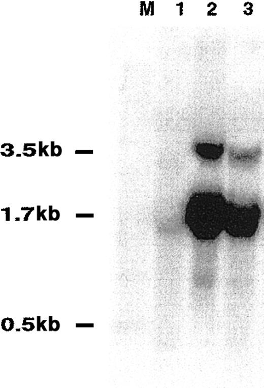 Fig. 3. Northern blot analysis of HGAL transcript size. / Total RNA from spleen (lane 1), Raji cell line (lane 2) and HF1 cell line (lane 3) was transferred to filters and hybridized with32P-labeled coding region HGAL cDNA probe. M indicates size marker.